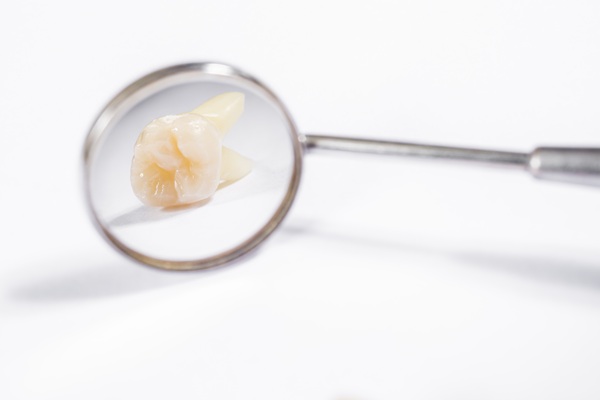 Why Dentists Consider Tooth Extraction A Last Resort